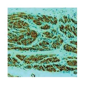 MART 1/Melan A (Melanoma Marker)   Concentrated Monoclonal Antibodies 