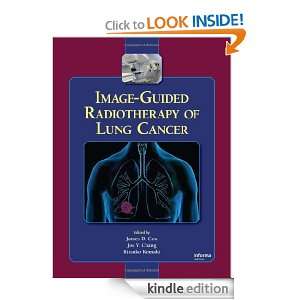 Image Guided Radiotherapy of Lung Cancer James D. Cox, Joe Y. Chang 