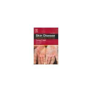 Skin Disease Diagnosis And Treatment