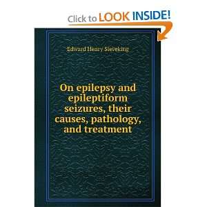  On epilepsy and epileptiform seizures, their causes 
