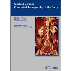   Computed Tomography of the Body [Hardcover] Mathias Prokop Books