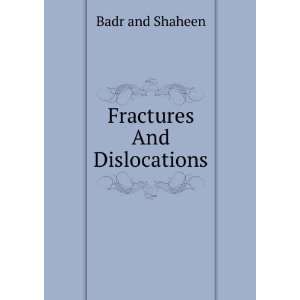  Fractures And Dislocations Badr and Shaheen Books