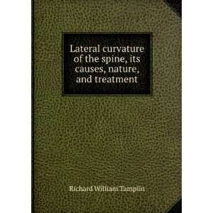  Lateral curvature of the spine, its causes, nature, and 