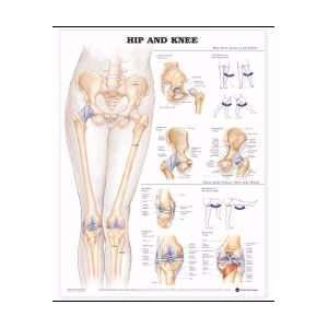 Hip & Knee Chart 26 X 20 (Catalog Category Physician Supplies 